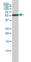IHC-plus™ PTBP1 Antibody (clone 3H8)