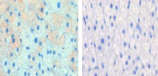 CPT1A Antibody (aa606-636)