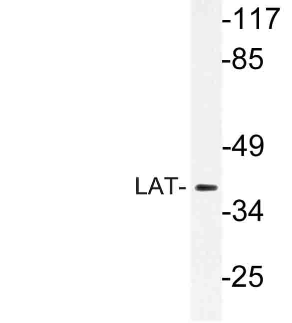 LAT Antibody (Asp156)