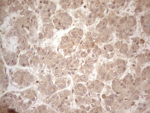 Monoclonal Mouse anti-Human PPP1CA / PP1-Alpha Antibody (clone OTI6E5, IHC, WB)