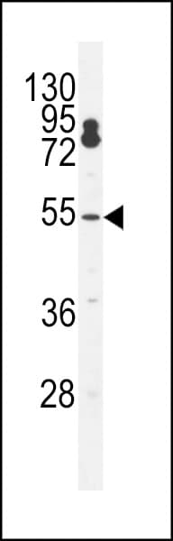 Polyclonal Rabbit anti-Human FLJ12529 / CPSF7 Antibody (aa427-455, WB)