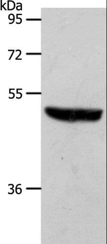 S1PR1 / EDG1 / S1P1 Antibody