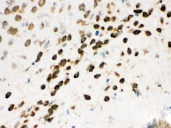 NONO / P54NRB Antibody