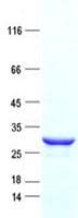 Human UCP2 Protein (Recombinant His, N-Terminal)