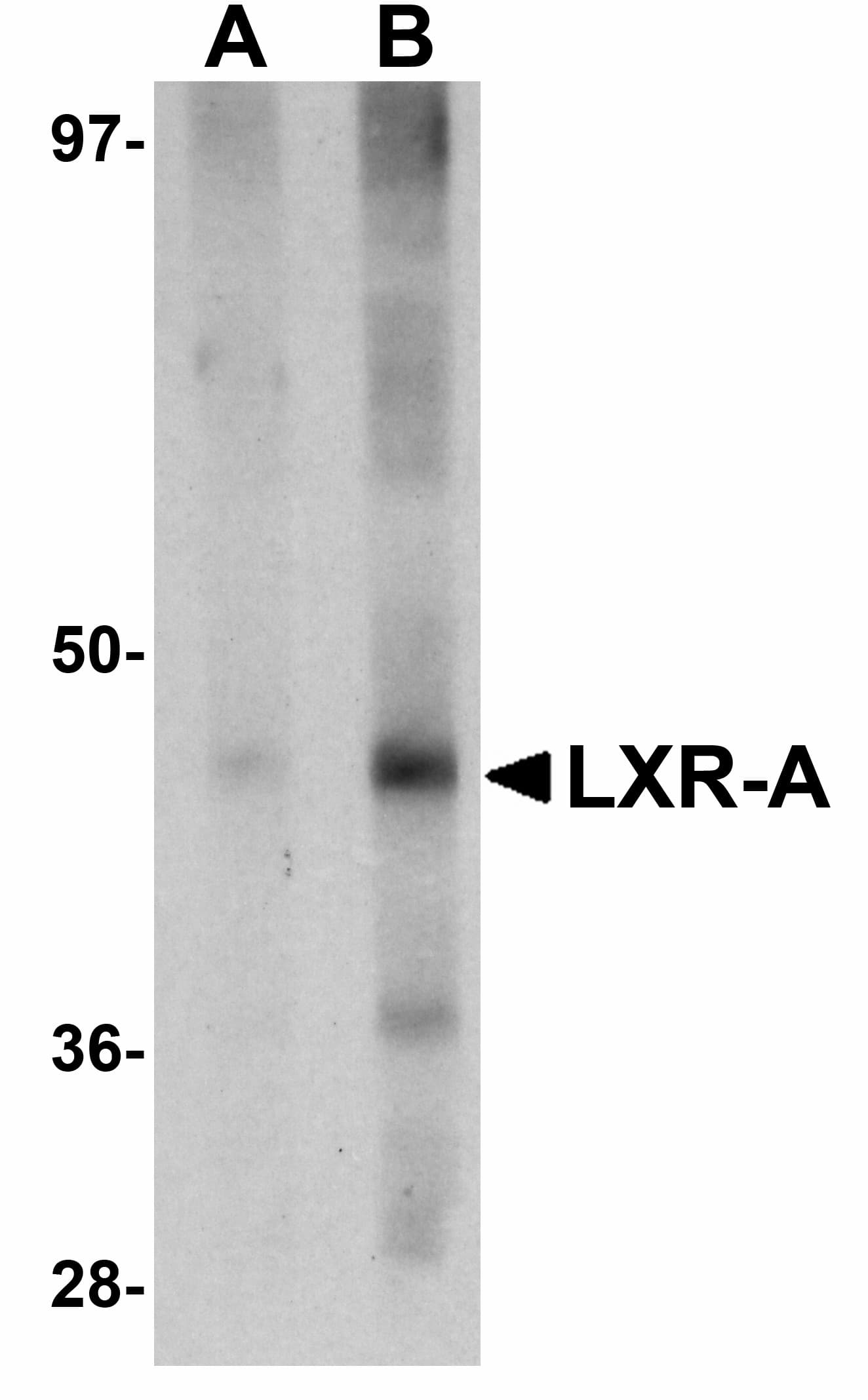 IHC-plus™ NR1H3 / LXR Alpha Antibody