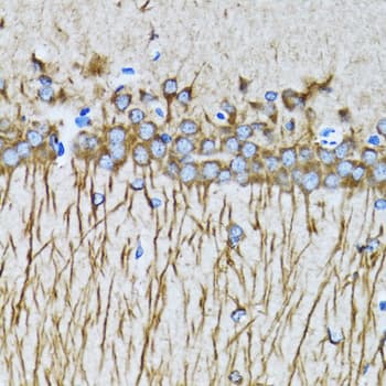 MAP1LC3A / LC3A Antibody