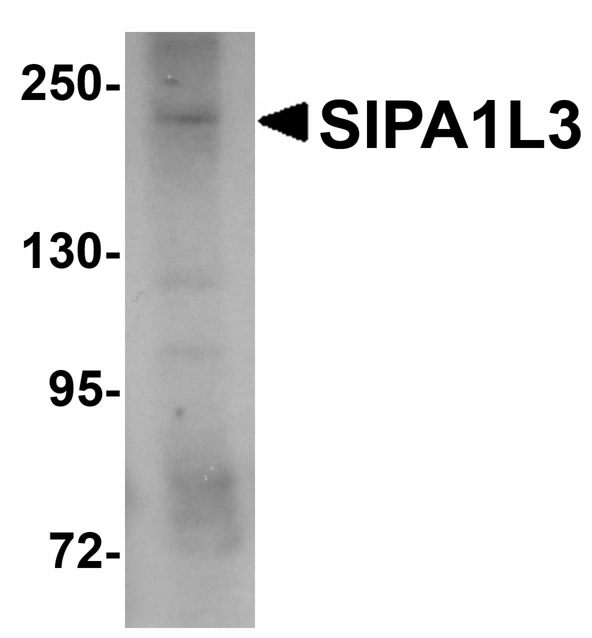 IHC-plus™ SIPA1L3 Antibody