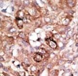 BAD Antibody (aa92-127)