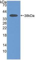 MAPT / Tau Antibody (aa130-386)