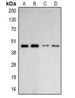 Polyclonal Rabbit anti-Human ACTR2 / ARP2 Antibody (IHC, WB)