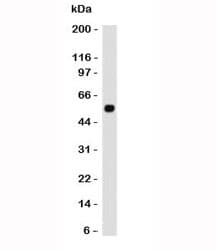 TP53 / p53 Antibody (clone CTA53-1)