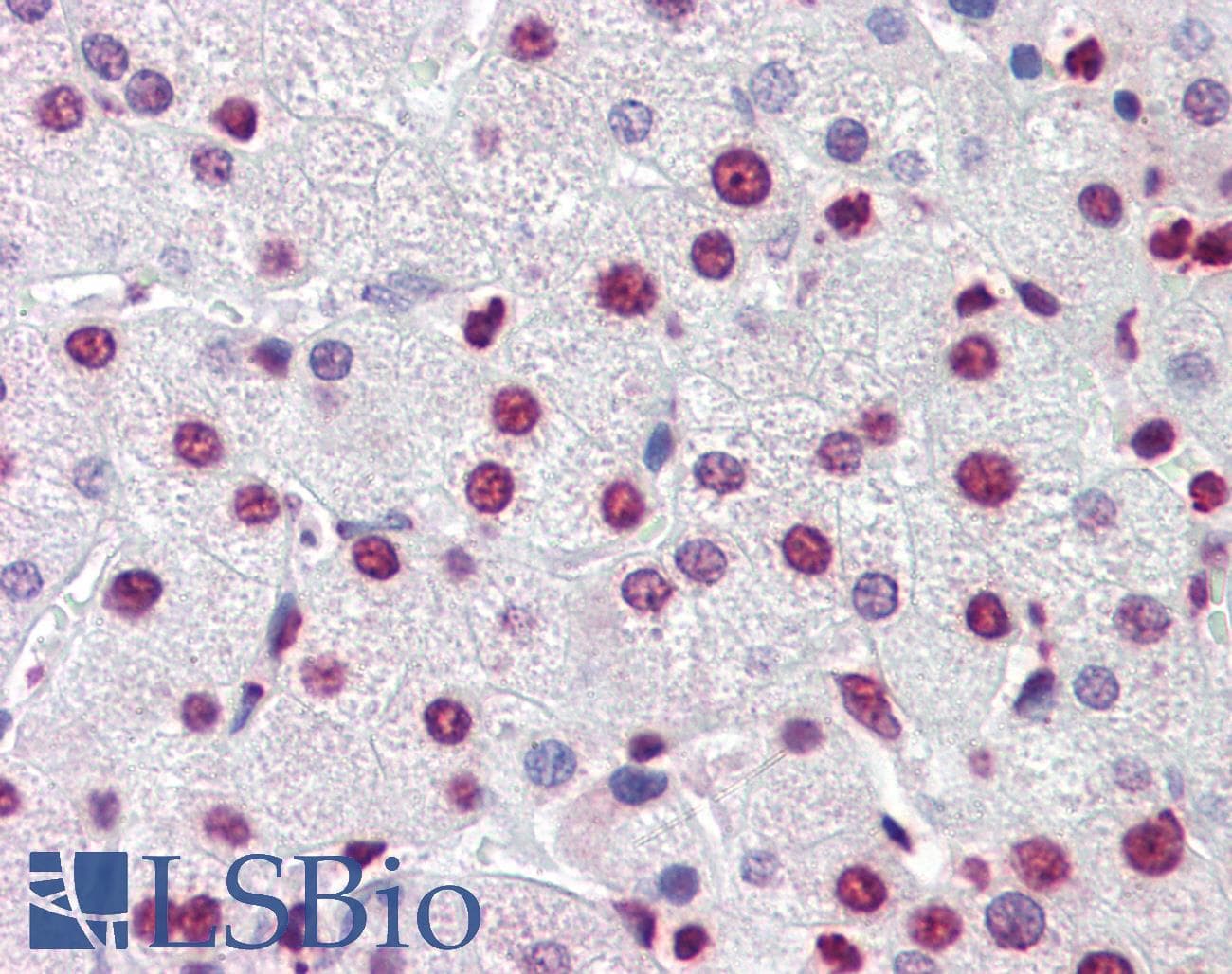 Polyclonal Rabbit anti-Human NR1H3 / LXR Alpha Antibody (C-Terminus, IHC, WB)