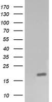 CTAG1B / NY-ESO-1 Antibody (clone OTI4C12)