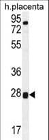 Polyclonal Rabbit anti-Human TOR2A Antibody (aa194-221, IHC, WB)