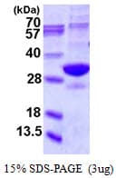 Human PSMA5 Protein (Recombinant His)