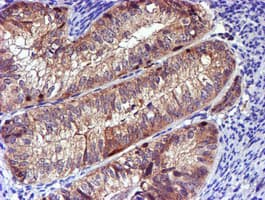 LIMK1 / LIMK Antibody (clone OTI6B4)