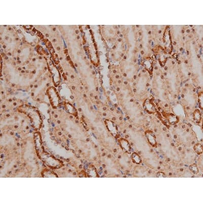 SP1 Antibody (phospho-Thr453)