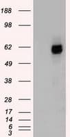 CHEK2 / CHK2 Antibody (clone OTI8D11)