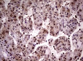 Monoclonal Mouse anti-Human NBN / Nibrin Antibody (clone OTI8E7, IHC, WB)