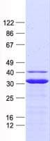 Human NADK2 / C5orf33 Protein (Recombinant His, N-Terminal)