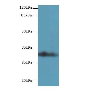 ASB8 Antibody