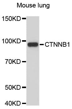 CTNNB1 / Beta Catenin Antibody
