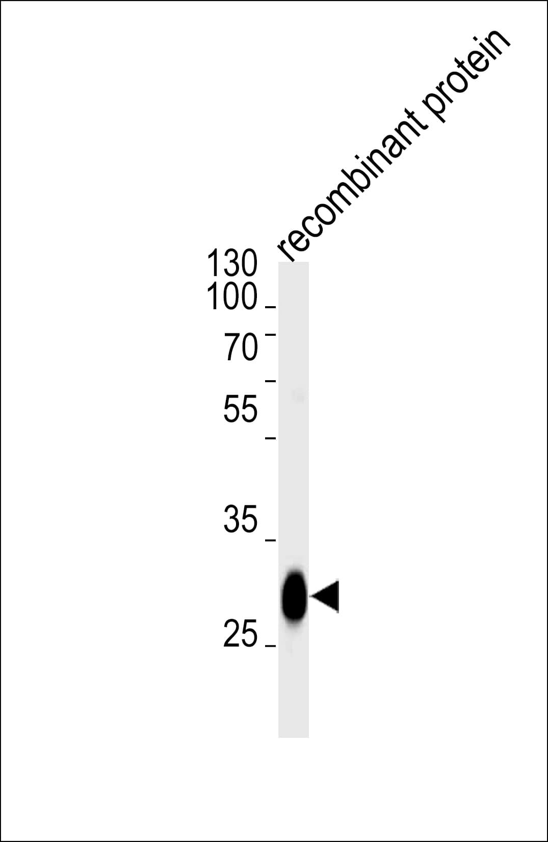 BCL2L1 / BCL-XL Antibody (clone 804CT19.1.4)