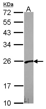 VBP1 Antibody (aa1-173)