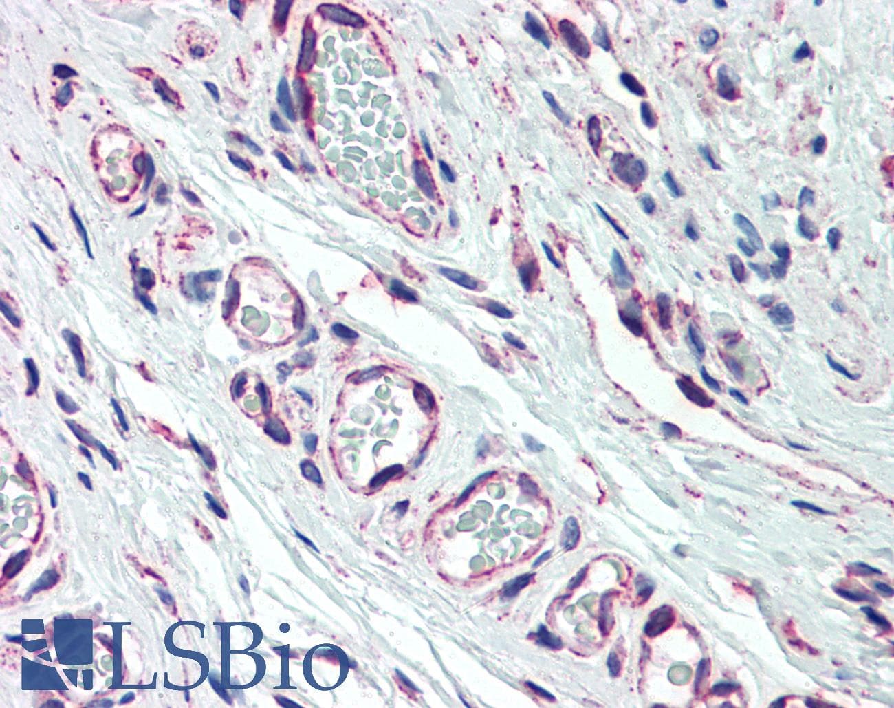 IHC-plus™ Monoclonal Mouse anti-Human PIK3C2A Antibody (clone 3E7, IHC, WB)