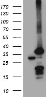 Monoclonal Mouse anti-Human PSMA7 Antibody (clone OTI10A6, WB)