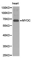 MYOC / Myocilin Antibody