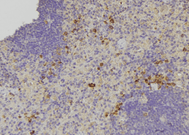 OXSR1 / OSR1 Antibody (phospho-Thr185)