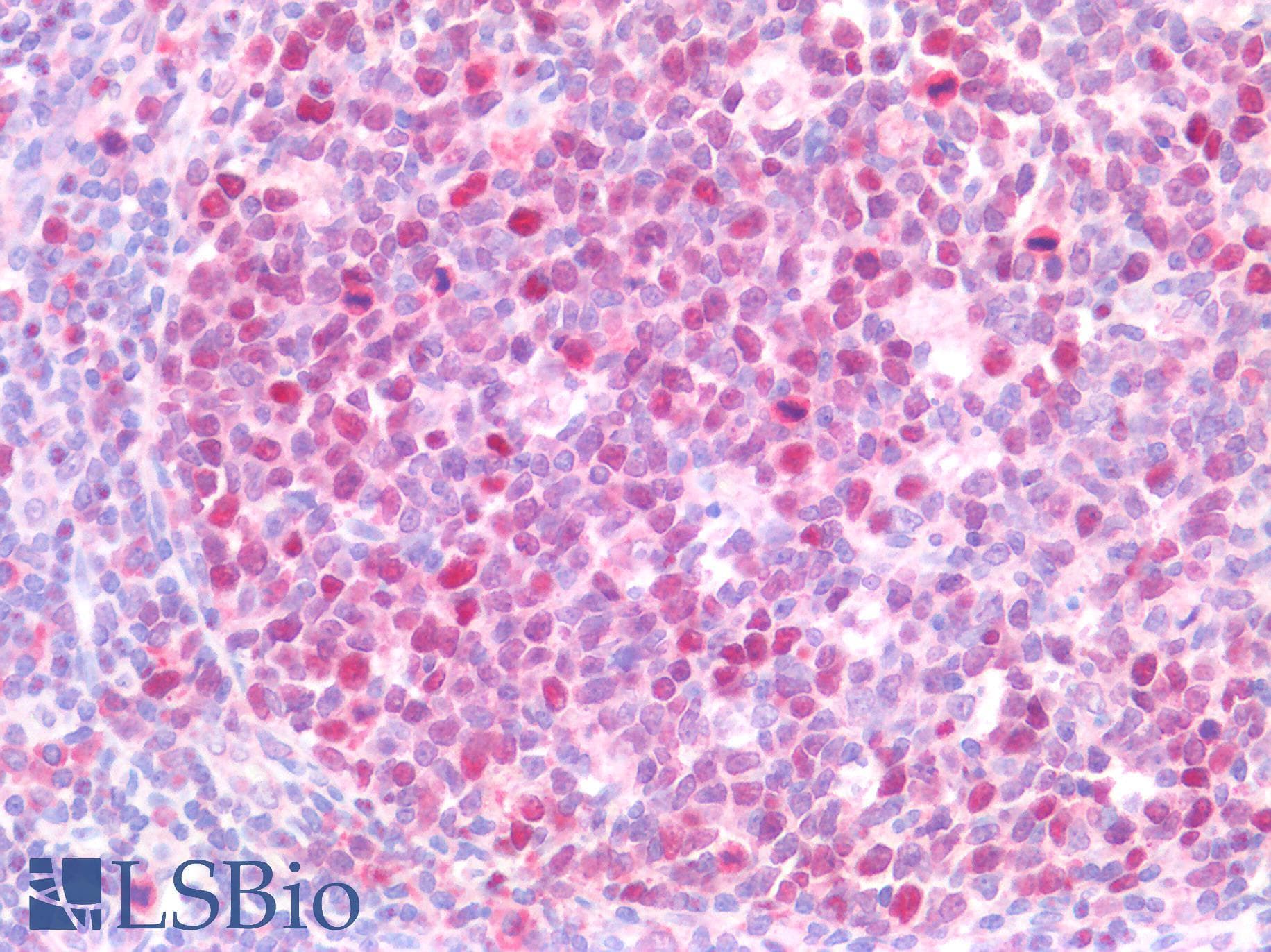 IHC-plus™ Polyclonal Goat anti-Human KPNA2 / Importin Alpha 1 Antibody (aa518-529, IHC, WB)