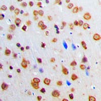 ADAR2 / ADARB1 Antibody (Internal)