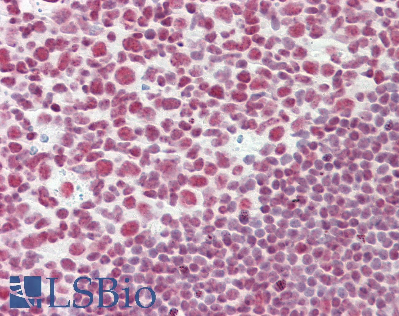 IHC-plus™ CELF2 / CUGBP2 Antibody (aa481-508)