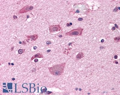 PathPlus™ Polyclonal Rabbit anti-Human GRM7 / MGLUR7 Antibody (N-Terminus, IHC, WB)