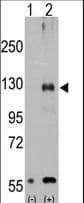 TRPM8 Antibody (aa521-552)