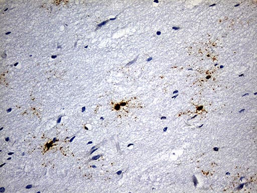 GPR17 Antibody (C-Terminus, clone OTI10B8)