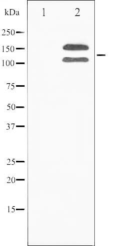 Polyclonal Rabbit anti-Human FGFR1 / FGF Receptor 1 Antibody (phospho-Tyr154, IF, WB)