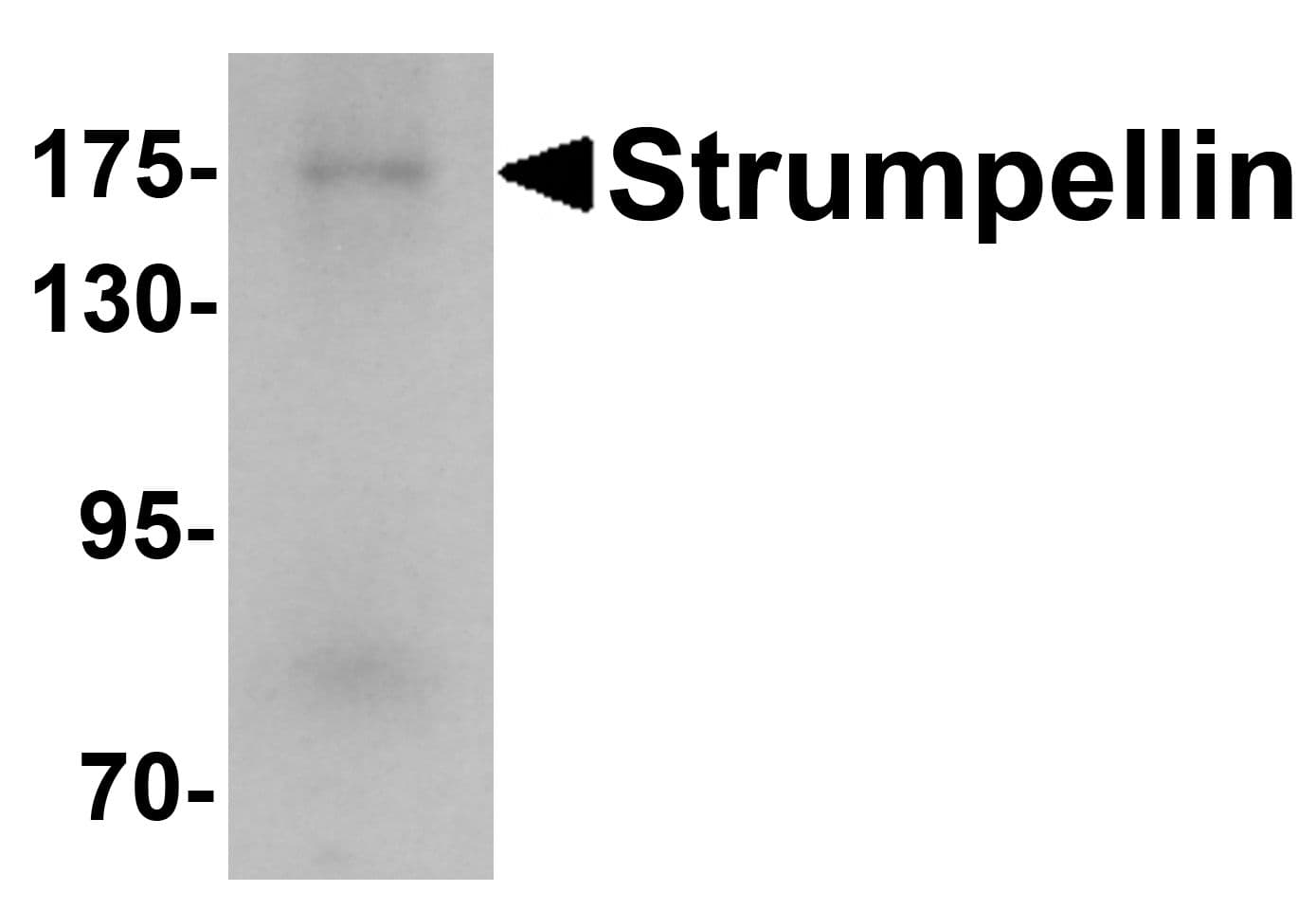 KIAA0196 Antibody