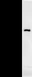 DHX29 Antibody (clone 2269C1)