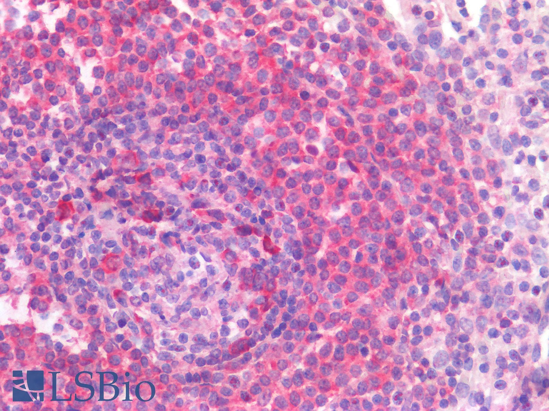 IHC-plus™ Monoclonal Mouse anti-Human Ribosomal protein S27 (metallopanstimulin 1) (RPS27) Antibody (clone 4A12, IHC)