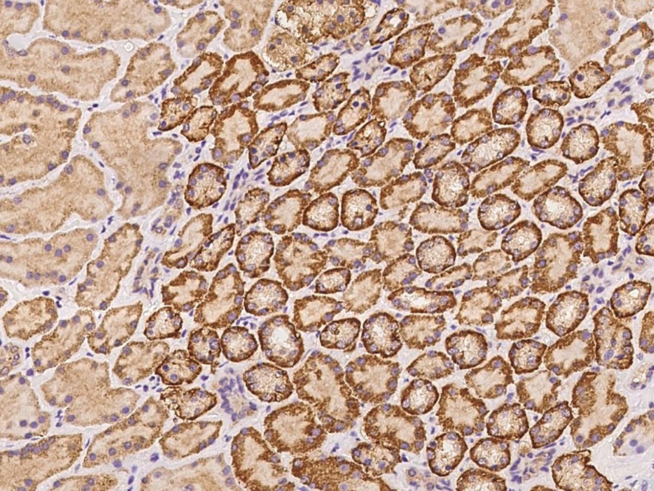 Polyclonal Rabbit anti-Human KLHL24 Antibody (IHC)