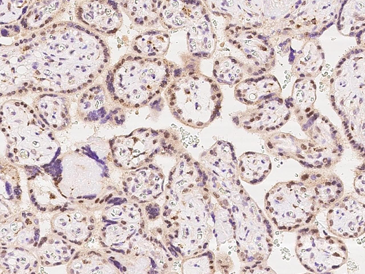RNGTT / HCAP Antibody