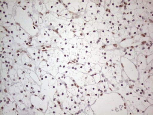 NR2C2 / TAK1 Antibody (aa1-241, clone OTI4B1)