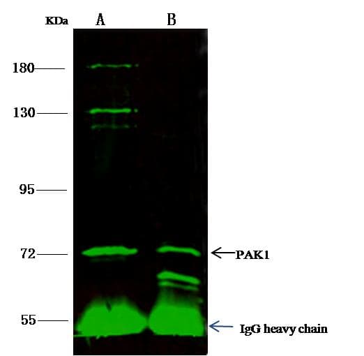 PAK1 Antibody (Preservative Free)