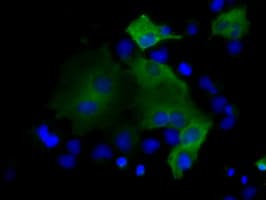 Monoclonal Mouse anti-Human PSMC3 Antibody (clone OTI7B10, IHC, IF, WB)