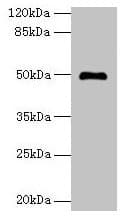 Polyclonal Rabbit anti-Human ADAL Antibody (WB)
