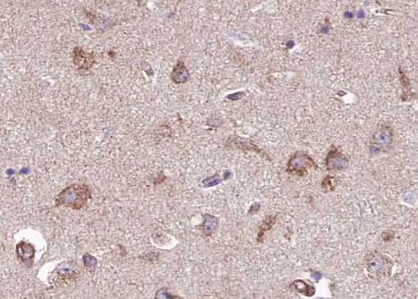 MAP3K8 / TPL2 Antibody (phospho-Thr290)