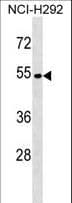 ATP6V1C2 Antibody (aa276-304)